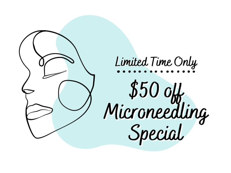 Limited Time Microneedling Special