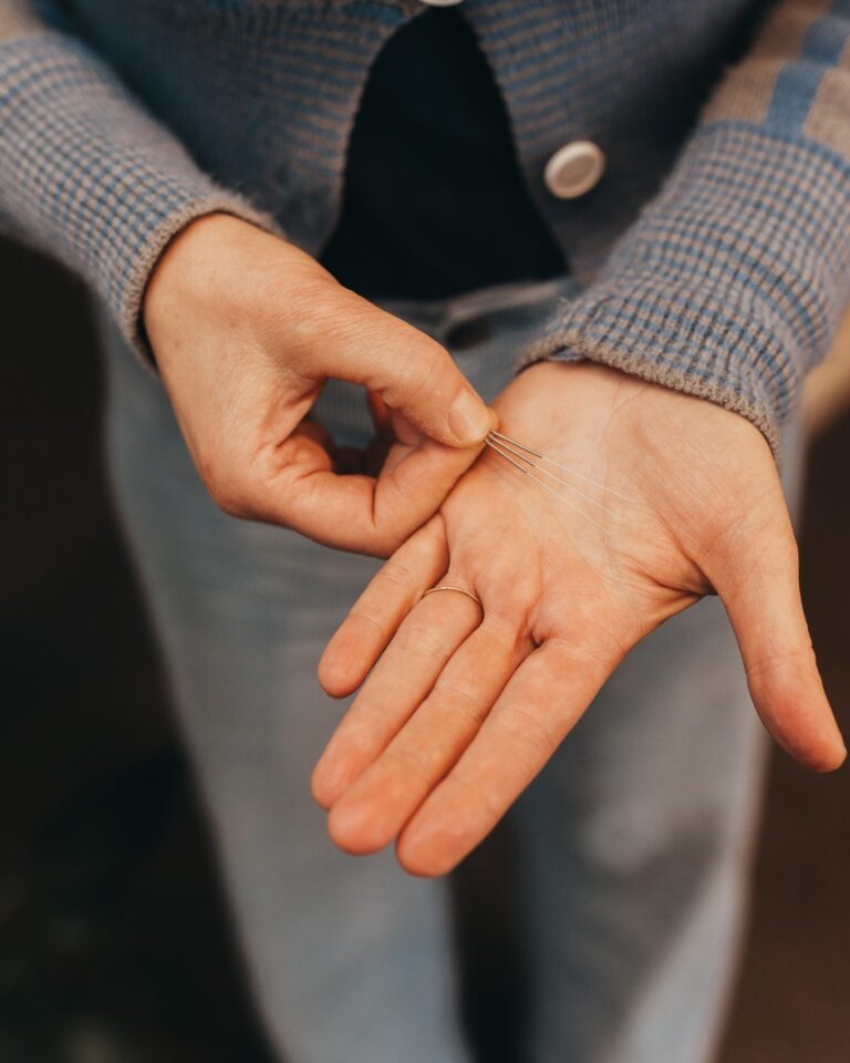 Hand held open with acupuncture needles