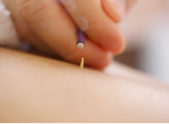 Moxa in Flemington NJ